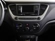 Hyundai Solaris 1.6 АКПП, 2017, 83 000 км превью 13